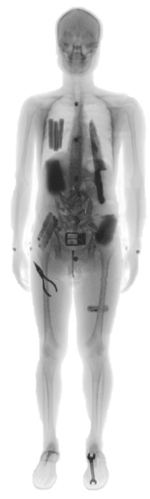 x ray full body scanner inspection image Your Human Security Scanner Manufacturer | Qilootech